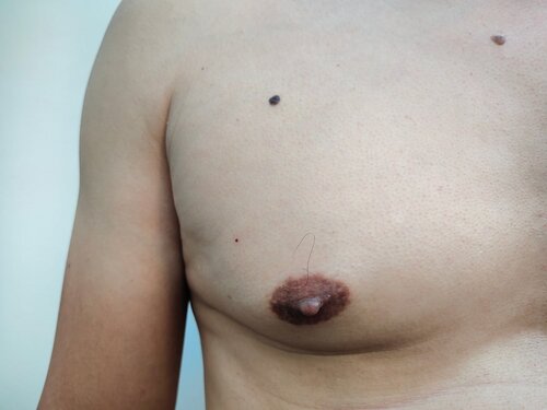 colin hinshelwood add long puffy nipples image