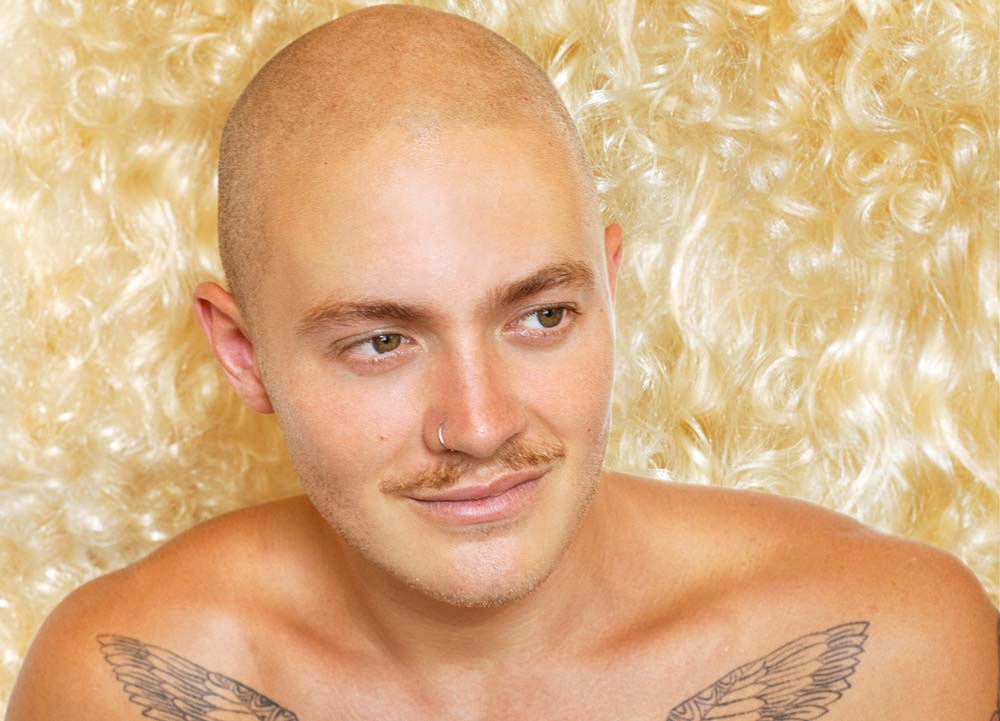 chris berney add bald twinks photo