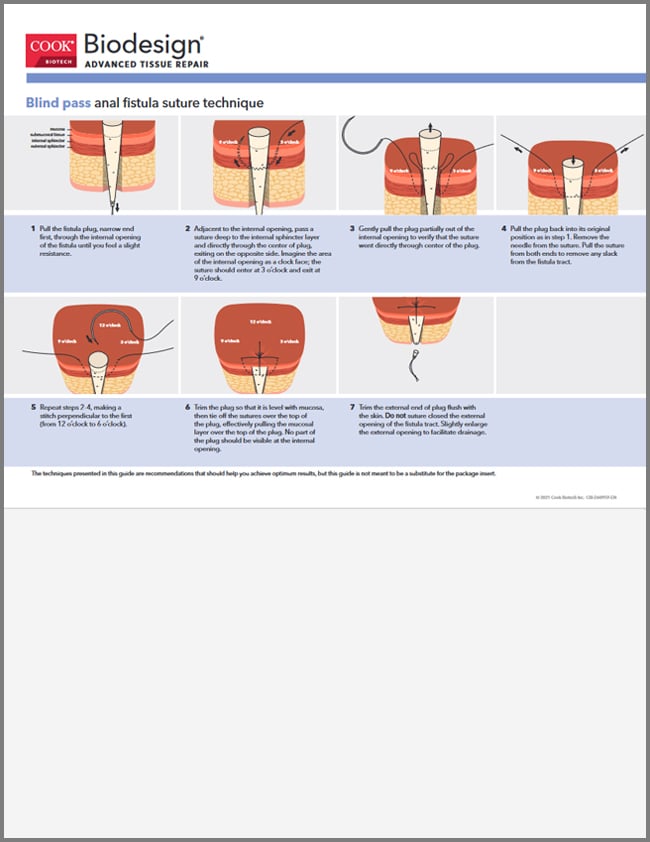 alyssa holton add anal fist guide photo